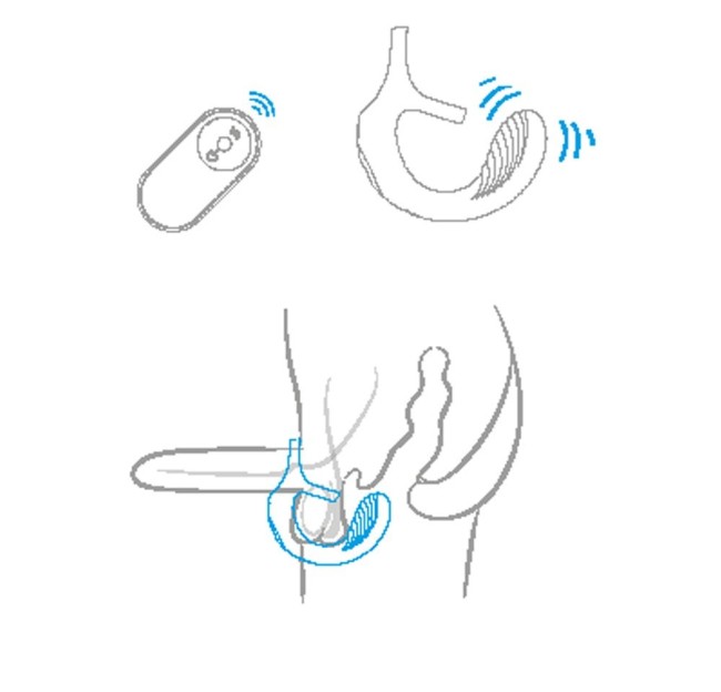 Черный анальный стимулятор с эрекционными кольцами Remote Couple Teaser Черный анальный стимулятор с эрекционными кольцами Remote Couple Teaser